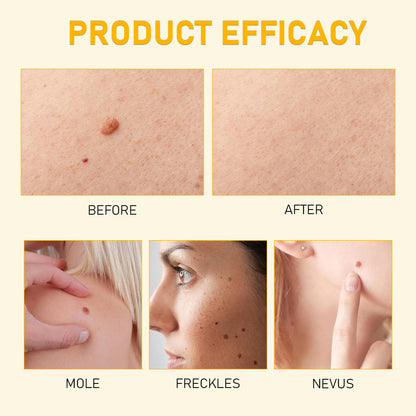 Bee Venom Skin Restoration Cream, Professional Bee Venom Skin Cream,Deeply Cleanses And Moisturizes, Effectively Reducing Blemishes(2PCS)