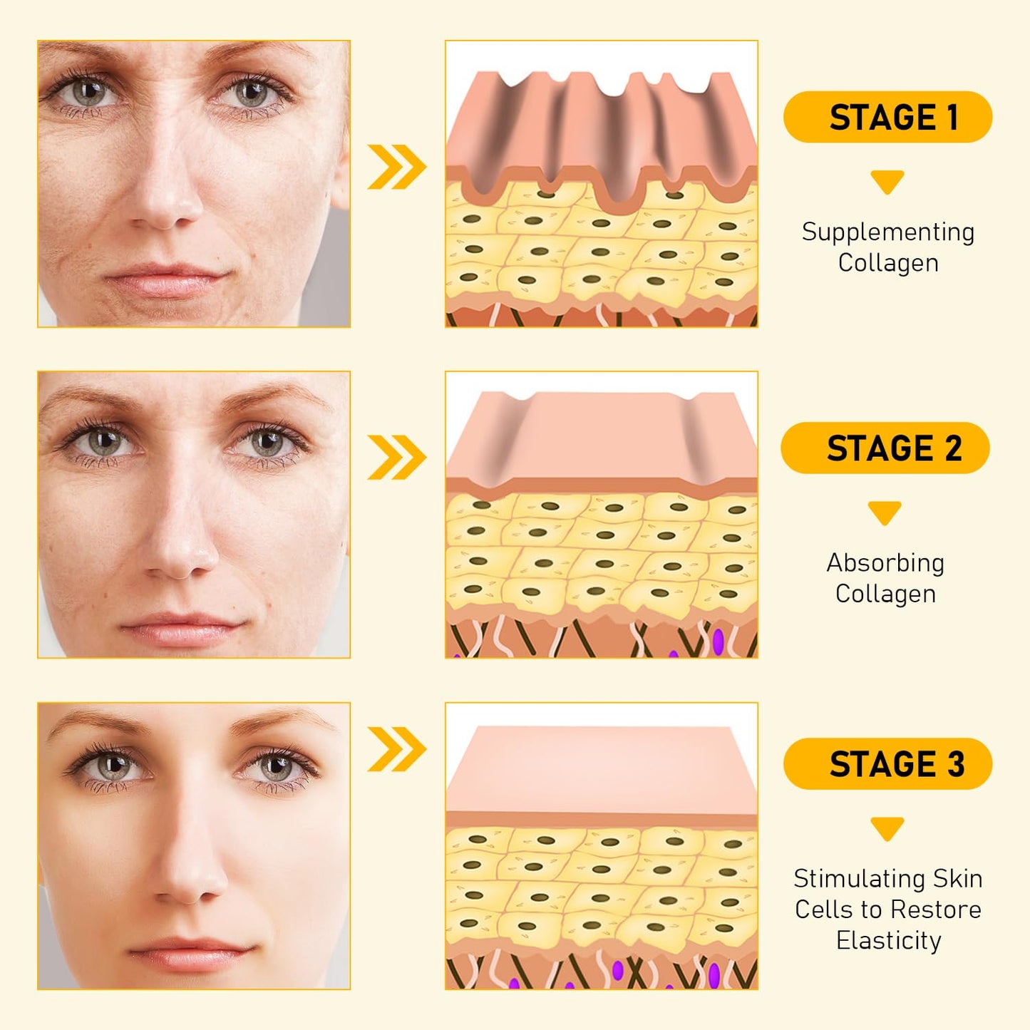 Bee Venom Skin Restoration Cream, Professional Bee Venom Skin Cream,Deeply Cleanses And Moisturizes, Effectively Reducing Blemishes(2PCS)