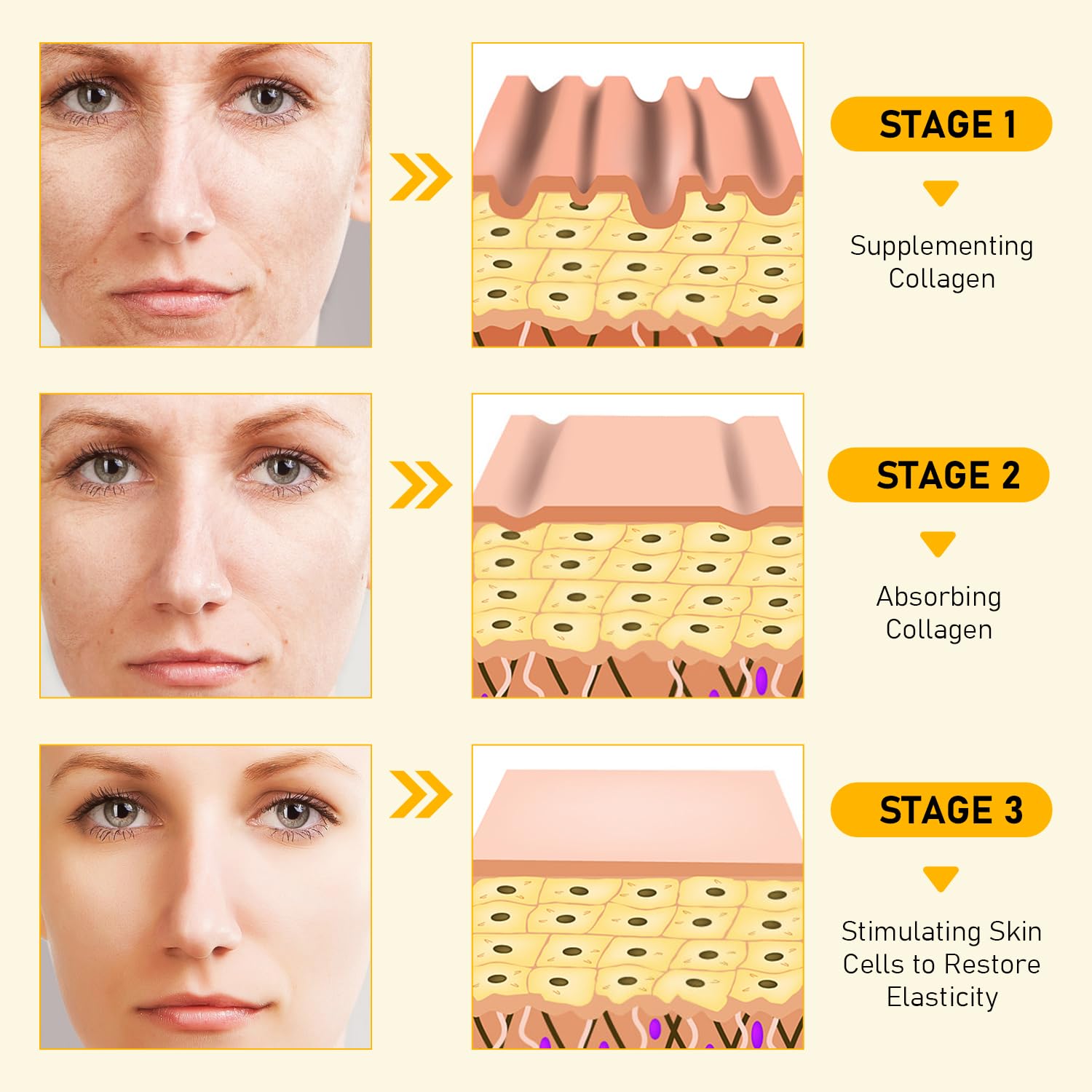 Bee Venom Skin Restoration Cream, Professional Bee Venom Skin Cream,Deeply Cleanses And Moisturizes, Effectively Reducing Blemishes(2PCS)