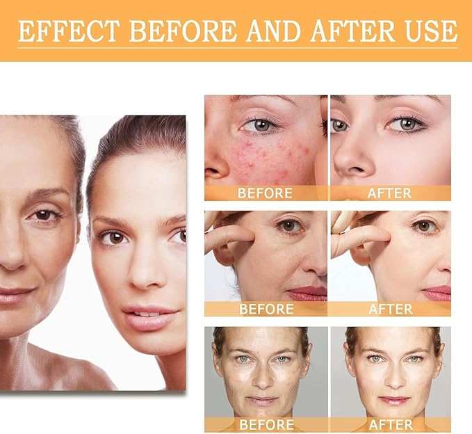 The Ordinary Glycolic Acid 7% Exfoliating Toner(240ML/8.FlOz)