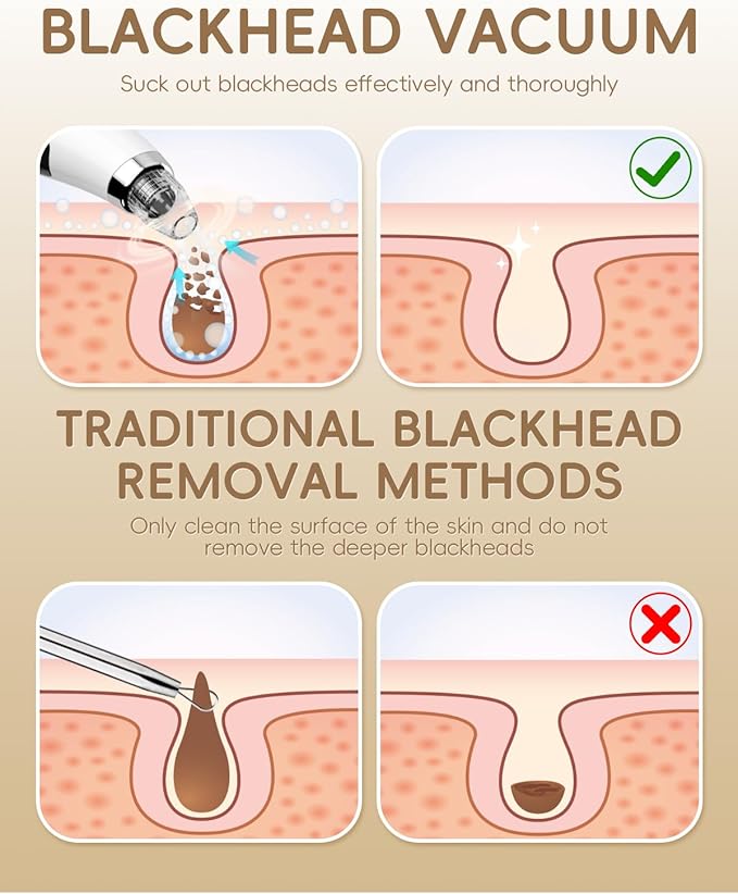 Facial Pore Blackhead Remover Vacuum