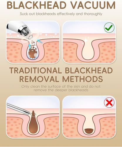 Facial Pore Blackhead Remover Vacuum