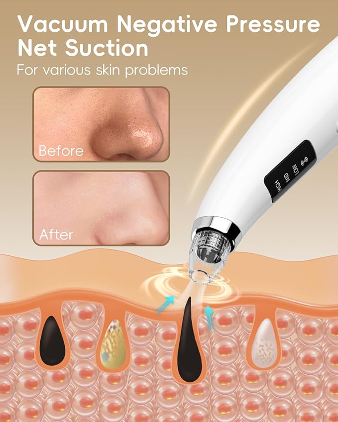 Facial Pore Blackhead Remover Vacuum