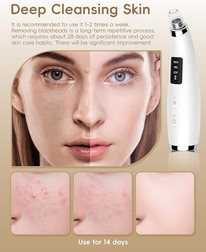 Facial Pore Blackhead Remover Vacuum